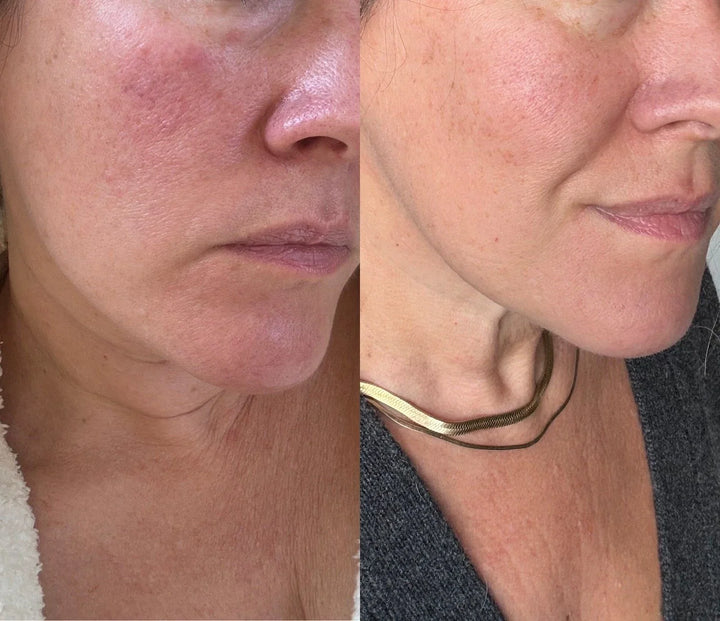 Dr. Melaxin Collagen Boost Set